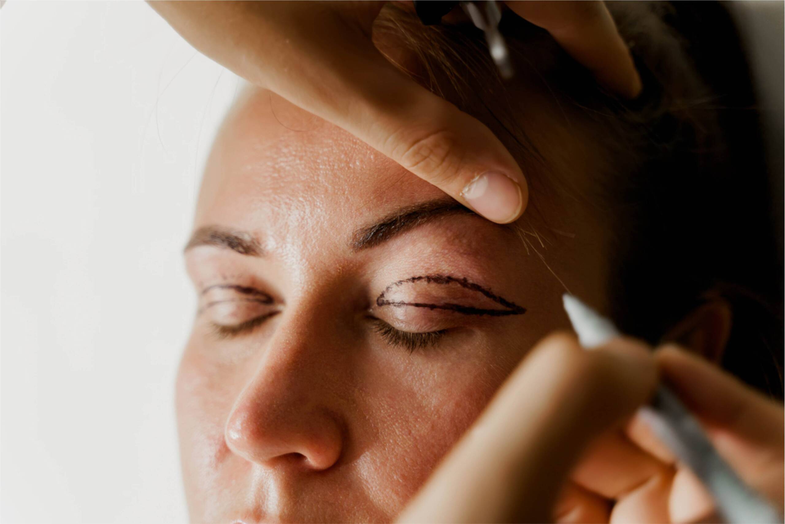 عملية شد الجفون